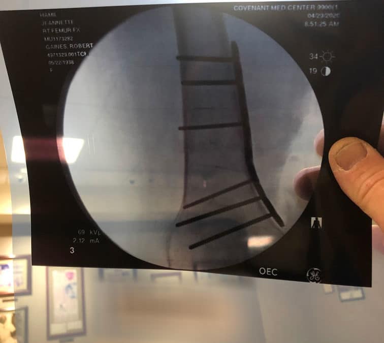 Jeannette is out of surgery (4-29am)