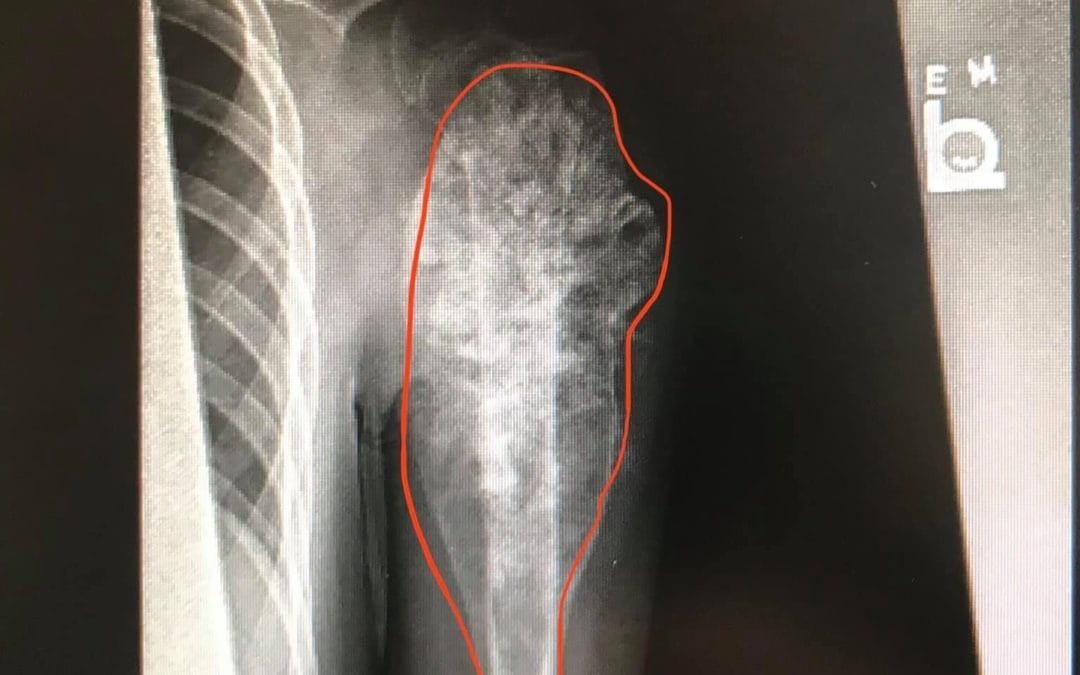 Update on Jasper (1-19-21)